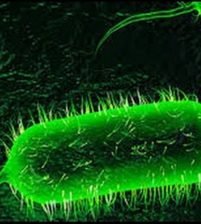 اليمن:السعودية سبب الكوليرا لاستكمال الحرب