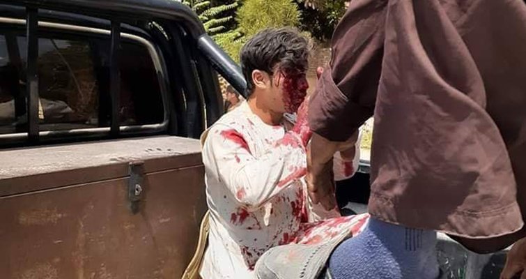 درگیری مهاجمین با نیروهای امنیتی در شهر ایبک